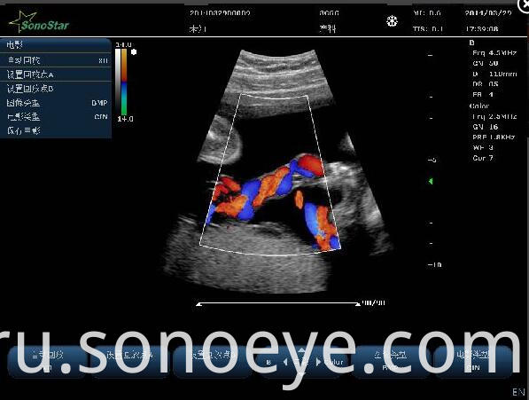 C10 Color Doppler Ultrasound System For Hostipal